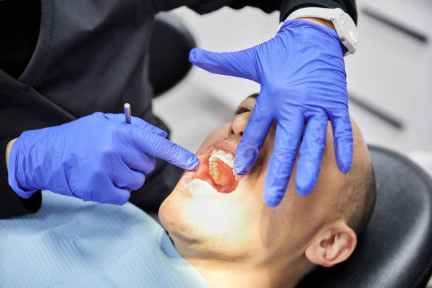 Best Emergency Tooth Extraction in Piketon, OH
